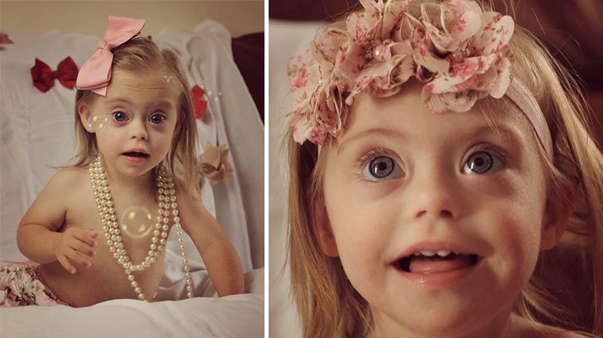 2-летняя девочка с синдромом Дауна стала моделью благодаря своей нахальной улыбке